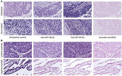 miR-182 and miR-183 Promote Cell Proliferation and Invasion by Targeting FOXO1 in Mesothelioma